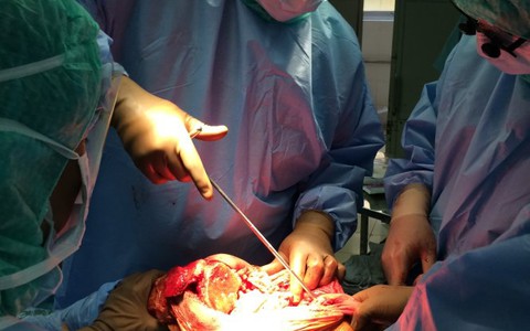 Thay khớp gối cho bệnh nhân bị ung thư xương đùi