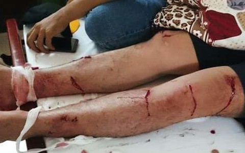 Nhóm cascadeur bị hành hung rút đơn yêu cầu khởi tố vụ án