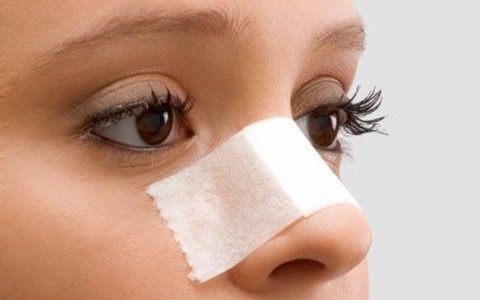 Sức khoẻ của bạn: Hiểu về lệch vách ngăn mũi