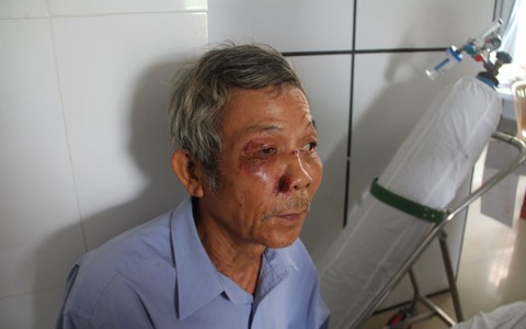 Bị cán bộ phường đánh vì... góp ý với đoàn nghiệm thu?
