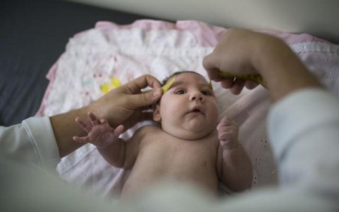 Virút Zika có thể gây mất mô não bào thai