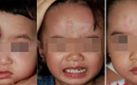 Phương pháp mới điều trị bệnh hiếm