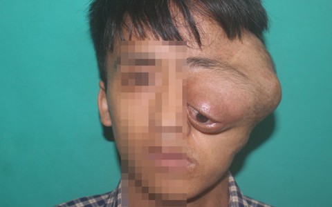 Bệnh nhân nghèo đi khám gặp “cò” lừa