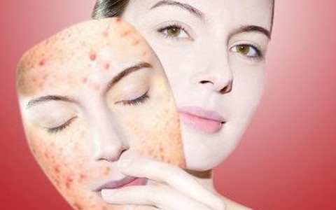 Điều trị mụn đột phá sau 3 ngày với công nghệ Nano hàng đầu của Mỹ