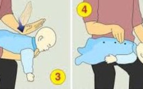 Sơ cứu đúng cách sặc sữa ở trẻ em