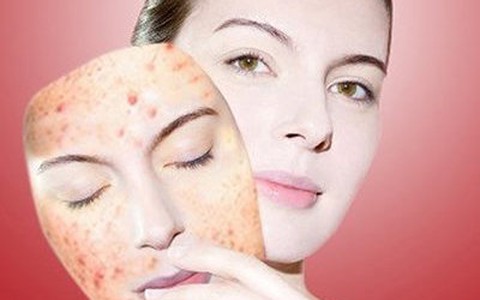 Điều trị mụn đột phá sau 3 ngày với công nghệ Nano hàng đầu của Mỹ