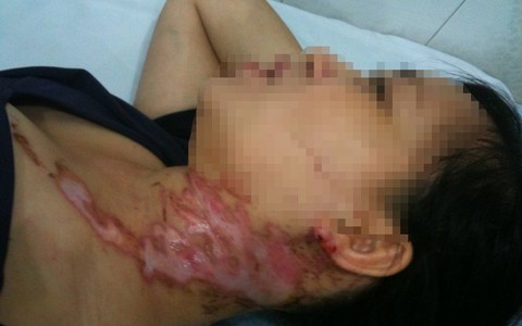 Công an quận Tân Phú mời phụ nữ bị đe dọa lên làm việc