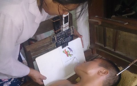 Đằng sau câu chuyện chàng trai
tình nguyện ghép đầu...
