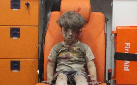 Cậu bé Syria thành biểu tượng nỗi đau chiến tranh