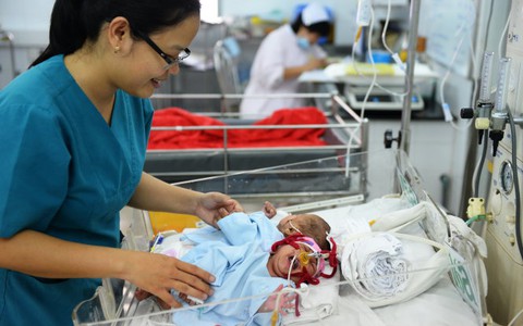 Chuẩn bị mổ tách hai bé dính nhau