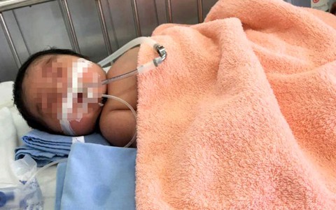 Làm rõ nguyên nhân tử vong trẻ sơ sinh tại Đắk Lắk