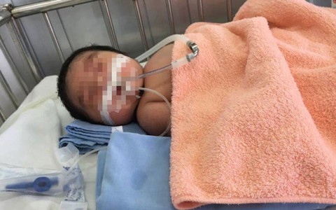 Bệnh viện Đắk Lắk chưa phát hiện sai sót vụ trẻ tử vong