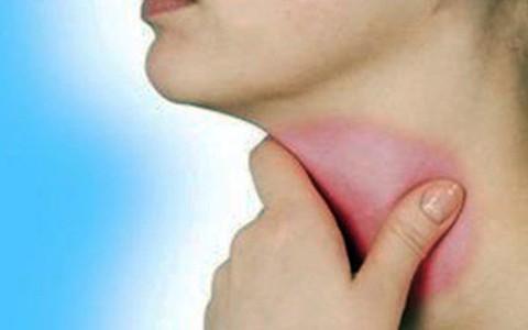 Sức khỏe của bạn: Amidan hốc mủ