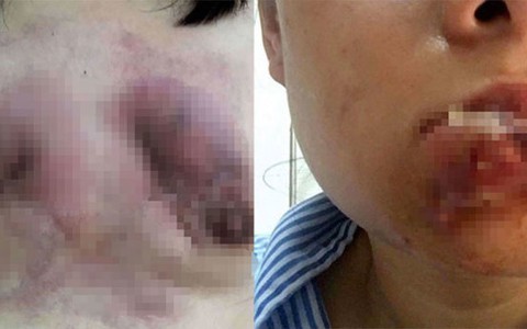 Audio 6-10: Khốn khổ vì thẩm mỹ