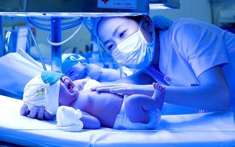 Không nên chủ quan khi thấy trẻ sơ sinh bị vàng da