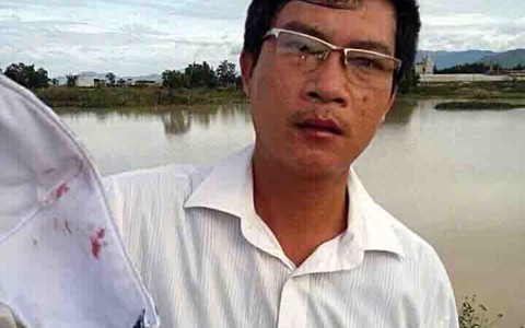 Phó chủ tịch xã bị giám đốc doanh nghiệp đánh chảy máu miệng
