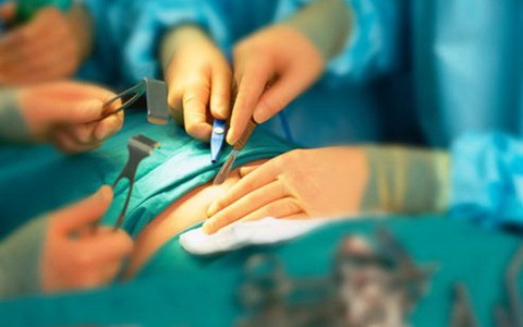 ​Phẫu thuật thắt dạ dày giúp điều trị bệnh tiểu đường tuýp 2