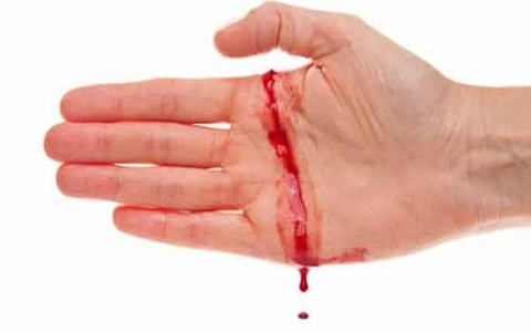 Bệnh máu không đông có nguy hiểm không?
