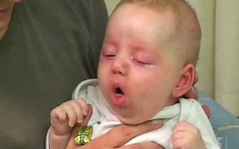 Ho gà có thể gây chết người, bác sĩ đừng bỏ qua