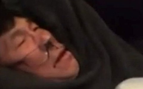 Hãng United Airlines dàn xếp vụ kiện với bác sĩ Dao
