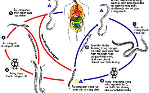 Thiếu máu do giun sán