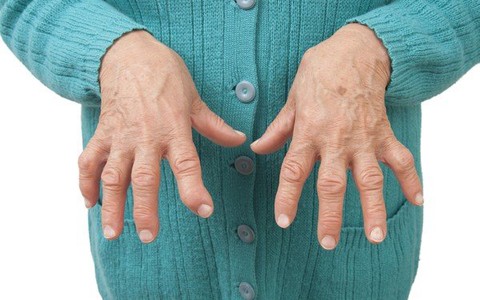 Bệnh viêm khớp dạng thấp