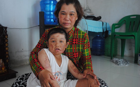 Hai bài học từ cơn sốt giá thịt heo