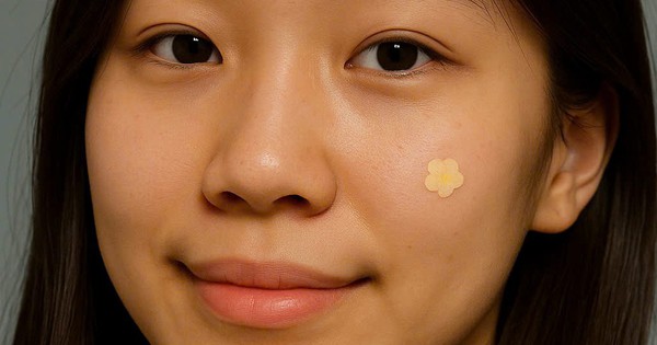 Miếng dán mụn có thật sự thần kỳ như lời đồn?