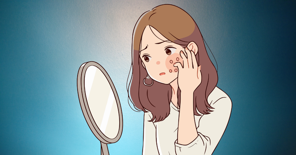 Vì sao bạn không nên tự ý nặn mụn?