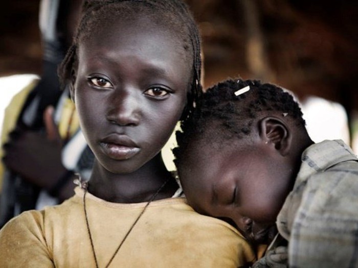 ​UNICEF: 1 triệu trẻ em châu Phi bị suy dinh dưỡng nghiêm ...