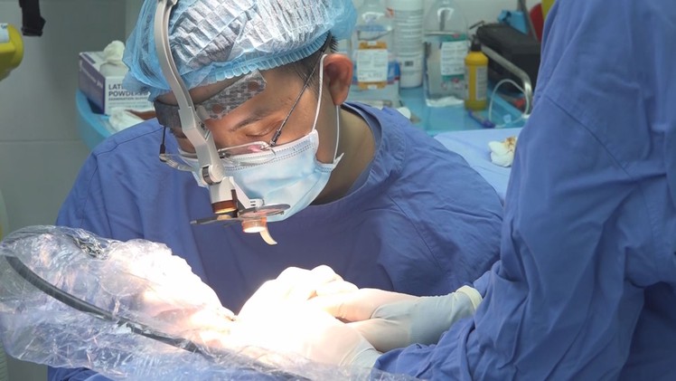 Góc nhìn trưa nay | Cẩn trọng khi điều trị hói đầu bằng phương pháp cấy tóc tự thân
