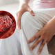 Ngồi lâu ở văn phòng, làm sao phòng ngừa nguy cơ hình thành cục máu đông?